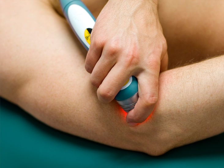 tennis-elbow-laser-therapy