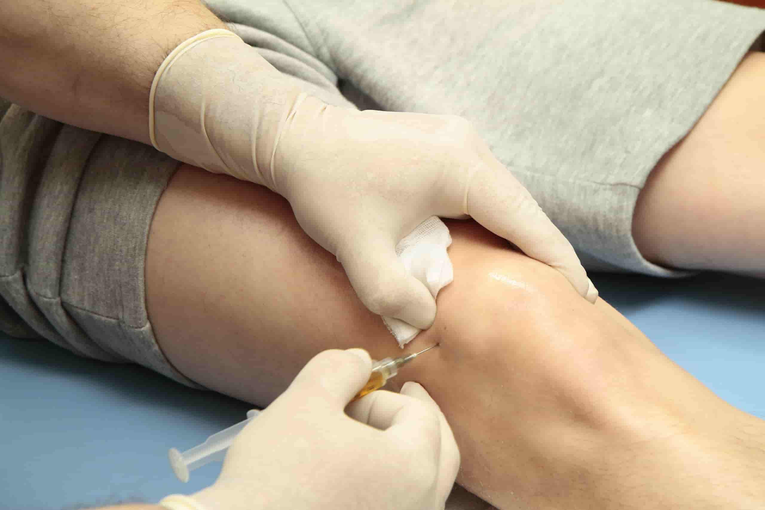 Physician performing stem cell therapy injection into the knee joint for osteoarthritis treatment