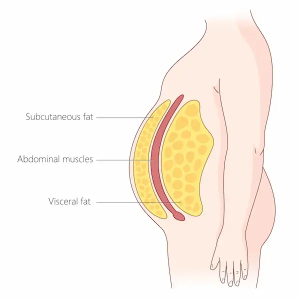 Visceral fat vs subcutaneous fat illustration in abdominal cavity Title: Visceral Fat vs Subcutaneous Belly Fat